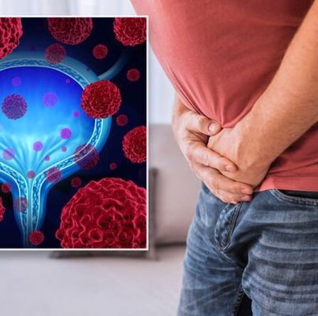 Cancer de la vessie : un nouveau test peut détecter un cancer de la vessie nouveau et récurrent - êtes-vous à risque ?