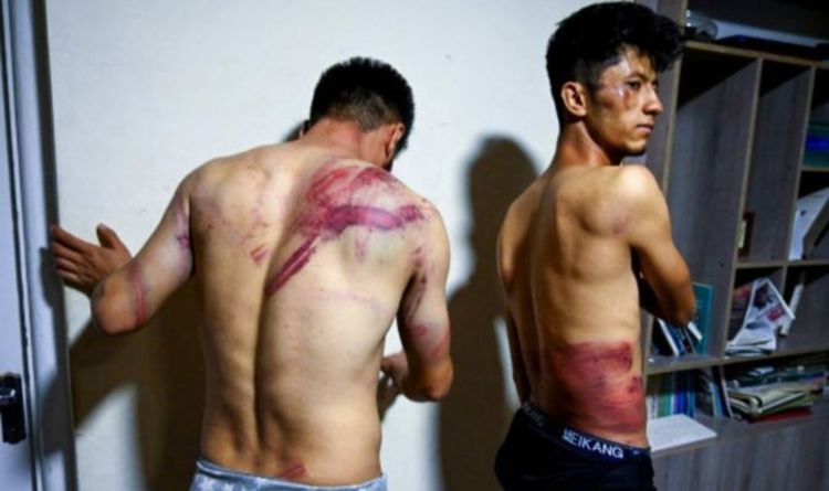Des images horribles montrent les blessures de journalistes afghans brutalement battus par les talibans