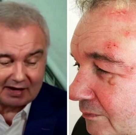 Eamonn Holmes admet qu'il « lutte » contre la douleur dans une nouvelle mise à jour sur la santé : « C'était un choc !