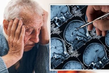 La percée d'Alzheimer en tant que nouvel algorithme précis à 99% pour identifier les changements cérébraux