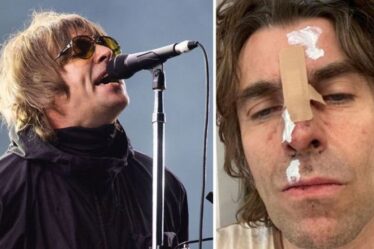 Liam Gallagher est parti avec le visage meurtri et coupé après être " tombé d'un hélicoptère "