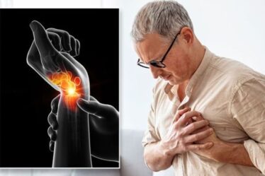 Percée dans l'arthrite : une étude trouve une nouvelle cause clé et un traitement « très efficace »