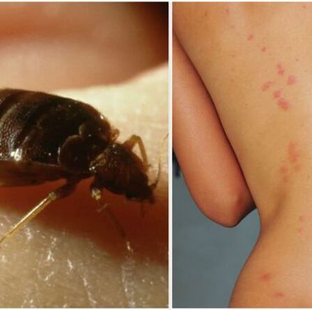 Piqûres de punaises de lit : comment savoir si vous avez une infestation - différence clé par rapport aux autres insectes