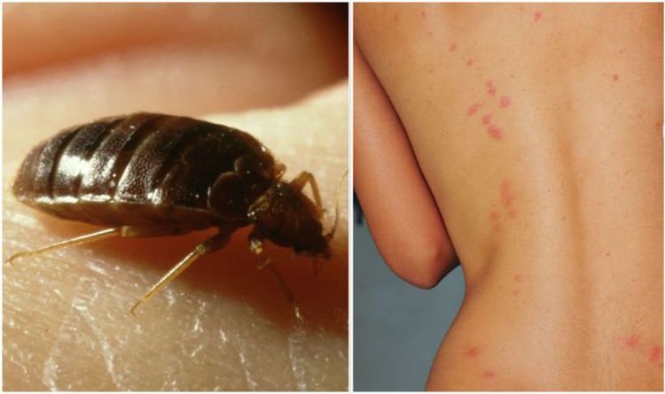 Piqûres de punaises de lit : comment savoir si vous avez une infestation - différence clé par rapport aux autres insectes