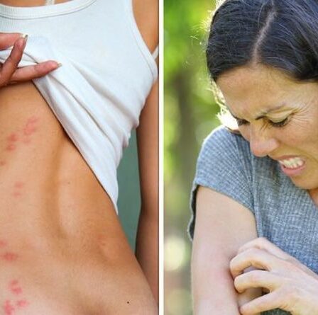 Punaises de lit : quatre signes révélateurs que vous avez une infestation secrète – que rechercher