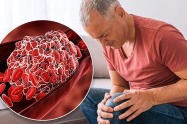 Symptômes de caillot sanguin : le marquage sur votre jambe qui pourrait signaler une thrombose veineuse profonde