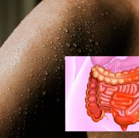Symptômes de la maladie de Crohn : le signe sur votre peau que vous pourriez avoir la maladie à vie