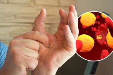 Symptômes d'hypercholestérolémie : le « signe important » de niveaux extrêmement élevés sur votre main