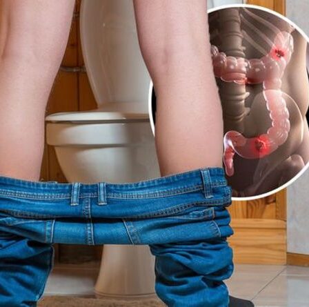 Symptômes du cancer de l'intestin : De quelle couleur est votre urine ?  Trois couleurs qui signalent le cancer de l'intestin