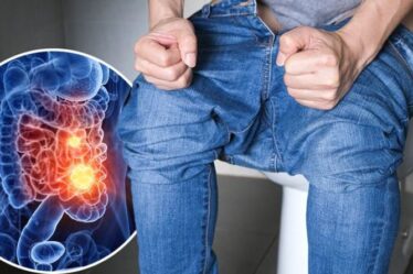 Symptômes du cancer de l'intestin : trois « changements soudains » dans vos habitudes intestinales qui peuvent être un signe