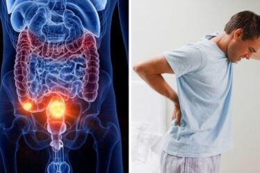 Symptômes du cancer de l'intestin : un signe rare mais douloureux dans le dos pourrait signaler un cancer
