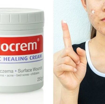 Utilisations de Sudocrem : 8 utilisations différentes de la crème anti-érythème fessier préférée