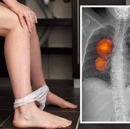 Cancer : le signe dans votre urine vous avertissant que vous avez « le type de cancer le plus grave »