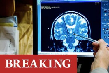 Épidémie de maladie mystérieuse: six morts alors qu'une enquête était lancée sur une maladie cérébrale inconnue