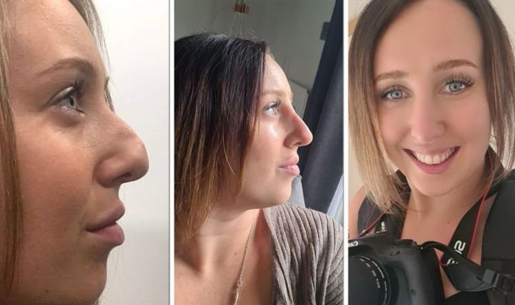 La transformation du nez d'une femme l'a fait "fondre en larmes" - "J'ai travaillé avec une main sur mon nez"