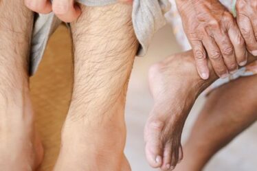 Taux de cholestérol élevé : cinq signes dans vos jambes auxquels vous devez vous attaquer "le plus tôt possible"
