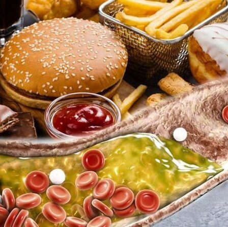 Taux de cholestérol élevé : le pire type d'aliment pour augmenter le cholestérol - quels aliments éviter