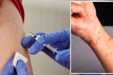 Vaccin Covid: L'effet secondaire apparaissant jusqu'à «1 mois» après avoir reçu le rappel Pfizer