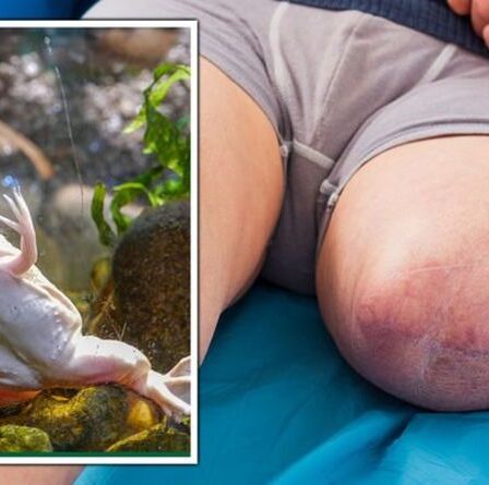 Vivez pour toujours : les cocktails à cinq médicaments offrent une énorme percée dans la régénération des membres humains