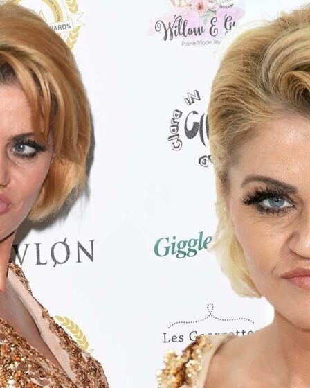 Danniella Westbrook subira une chirurgie faciale de 500 000 £ sur le NHS pour «survivre» après des problèmes de santé
