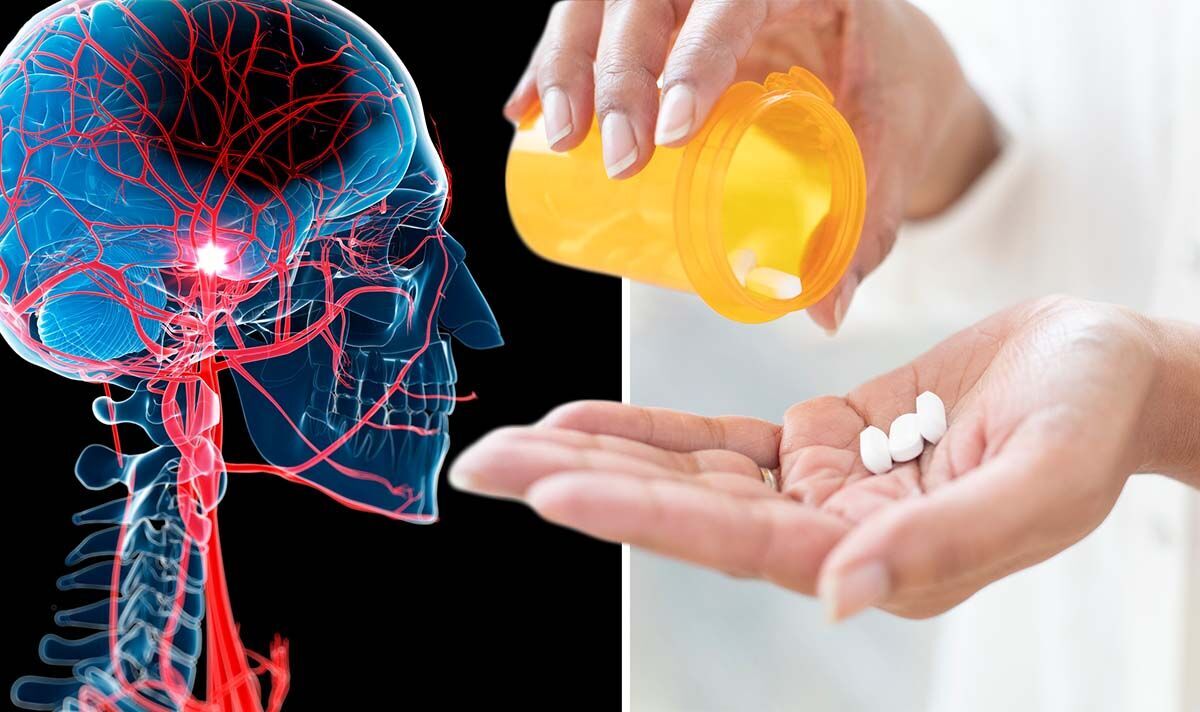 Accident vasculaire cérébral: un analgésique populaire pourrait réduire de 50% le risque d'urgence potentiellement mortelle