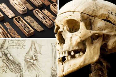 Pillage de tombes, meurtre et médecine moderne : j'ai visité l'ultime exposition d'Édimbourg