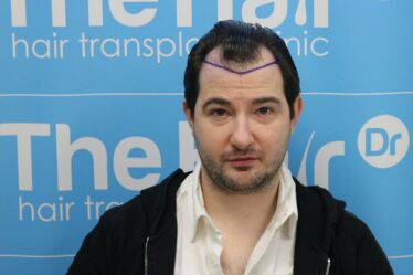 Un homme confondu avec Tinder Swindler après une greffe de cheveux de 7 500 £
