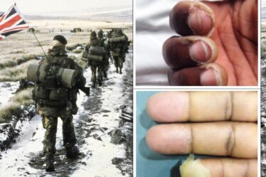 Les vétérans des Malouines font face à un vide juridique contre le ministère de la Défense pour des blessures de guerre d'horreur