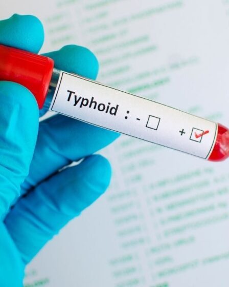 "Une réponse mondiale est nécessaire" alors qu'une maladie hautement contagieuse échappe aux antibiotiques - Royaume-Uni en alerte