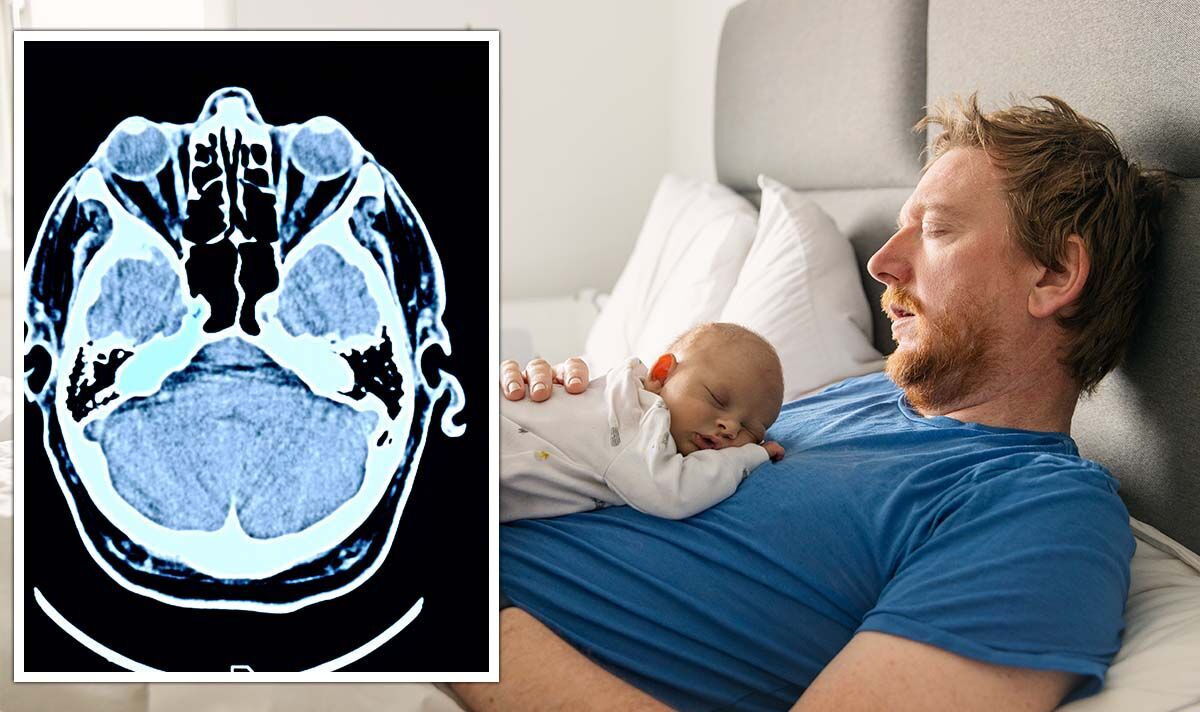Rétrécissement du cerveau: les hommes ont envoyé un avertissement car les nouveaux pères pourraient voir les cerveaux devenir PLUS PETITS