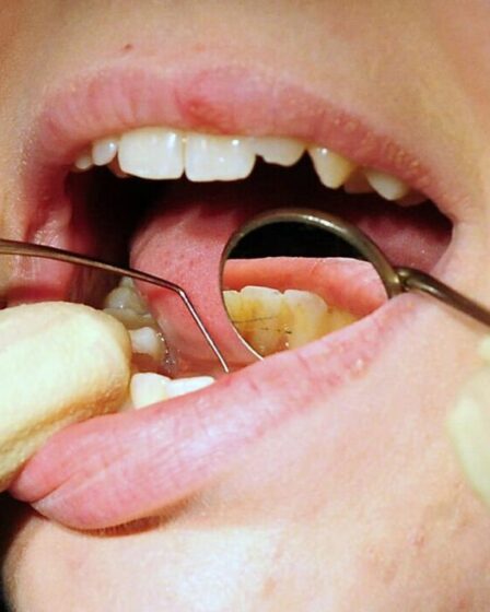 Les gens « arrachent leurs propres dents » en raison de la crise dentaire du NHS