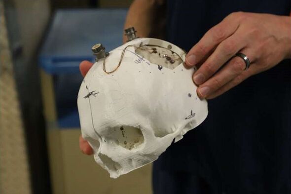 Un modèle imprimé en 3D du crâne de M. Thomas