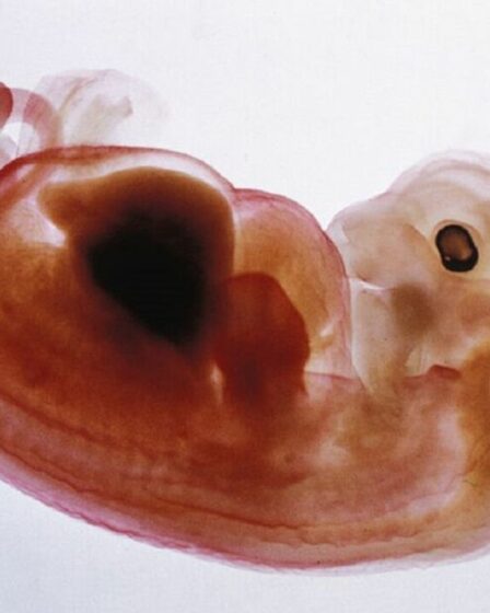 Percée dans la chirurgie de transplantation alors que des scientifiques cultivent des reins humains sur des embryons de porc