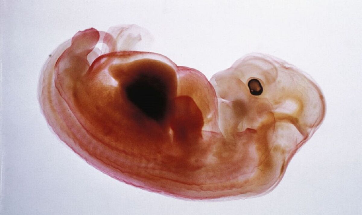 Percée dans la chirurgie de transplantation alors que des scientifiques cultivent des reins humains sur des embryons de porc