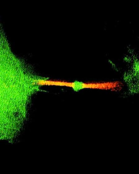 « Poubelle de la cellule » responsable de la propagation du cancer, prévient une nouvelle étude – de quoi s'agit-il ?