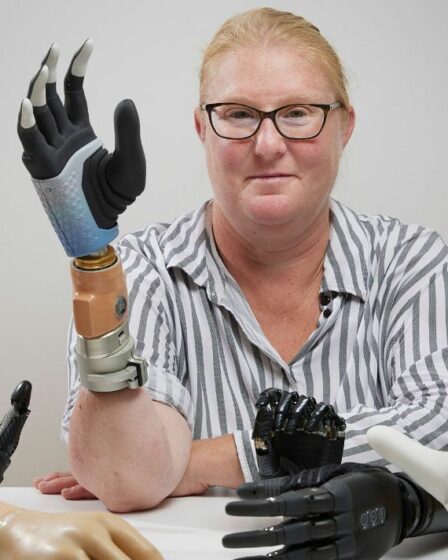 « Révolutionnaire » : une femme reçoit une main bionique qui fusionne avec ses nerfs et son squelette