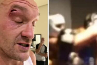 Le boxeur qui a coupé Tyson Fury brise le silence après avoir donné un coup de coude à Gypsy King – EXCLUSIF