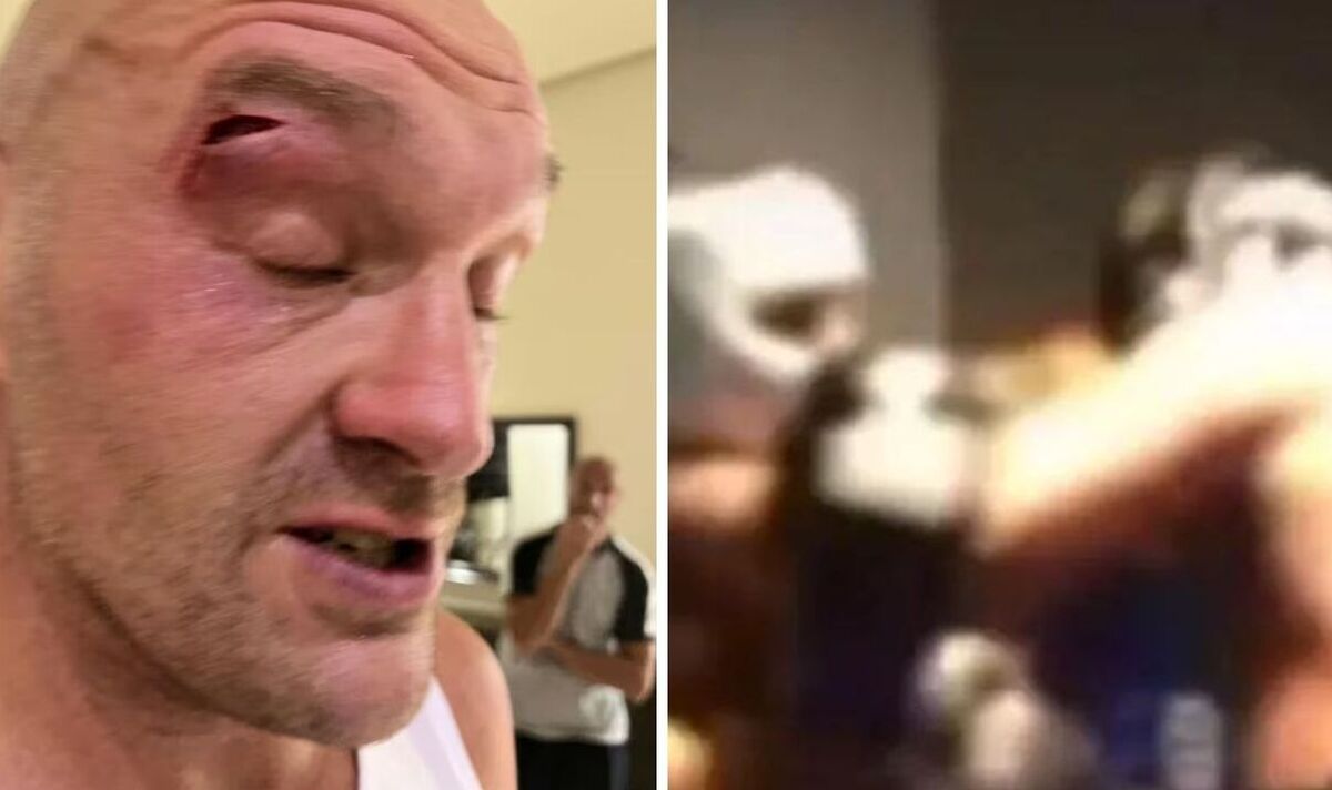 Le boxeur qui a coupé Tyson Fury brise le silence après avoir donné un coup de coude à Gypsy King – EXCLUSIF