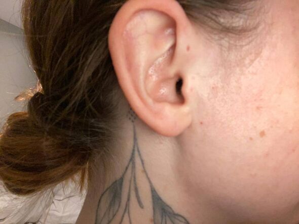 Le profil latéral du visage d'une personne - l'oreille présente une fosse pré-auriculaire