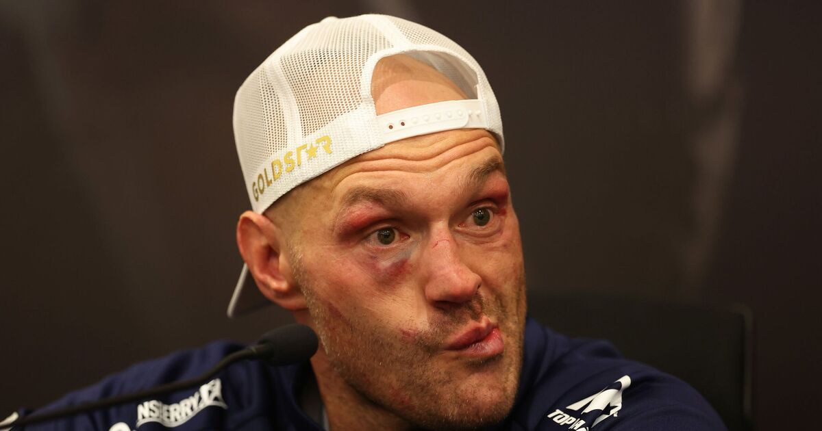 Tyson Fury fait une déclaration de retraite bouleversante alors que sa carrière de boxeur touche à sa fin