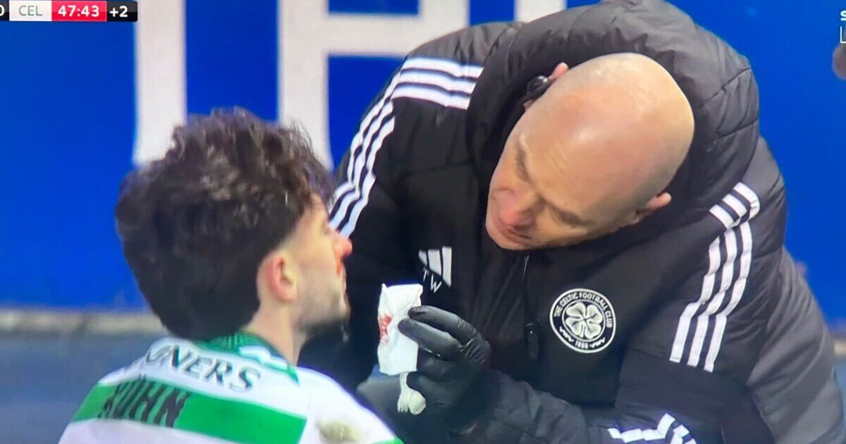 La star celtique est ensanglantée dans Old Firm alors que Chris Sutton se prononce sur un « méchant » incident