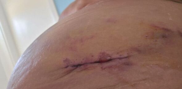 Une cicatrice sur le corps de Sian