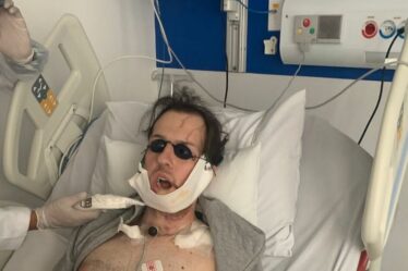 Un homme a la mâchoire reconstruite avec un os de jambe après une chute d'horreur en poursuivant un voleur