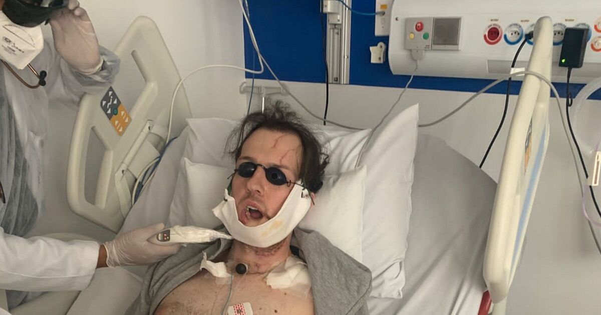 Un homme a la mâchoire reconstruite avec un os de jambe après une chute d'horreur en poursuivant un voleur